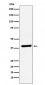 Anti-VEGFD Rabbit Monoclonal Antibody